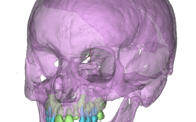 Building the skeletal biological profile